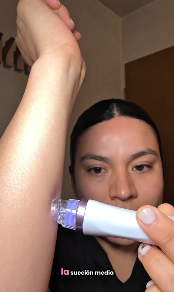 Parte 2 Hidrodermoabrasión 6 en 1, Si buscas una máquina que haga bien su trabajo, tenga buena succión y realmente exfolie y elimine impurezas, estás en el video correcto AF1323-MX