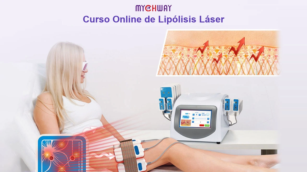 Curso en línea sobre lipólisis láser ES