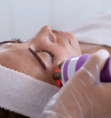 Radiofrecuencia Facial: Adiós a la Flacidez en la Cara