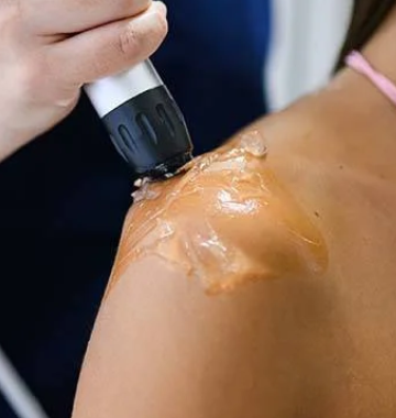 Terapia de Ondas de Choque: Celulitis y Dolor Muscular